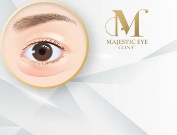 majesticeyeclinic-service3