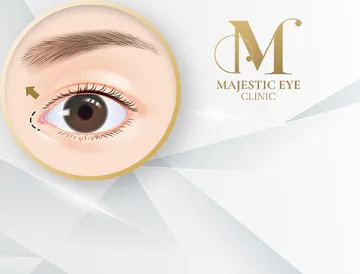 majesticeyeclinic-service4