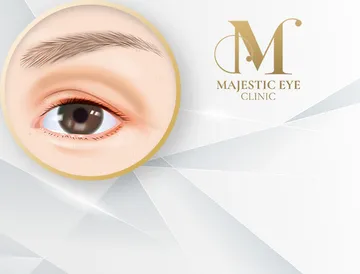 majesticeyeclinic-service6