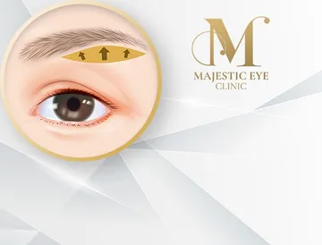 majesticeyeclinic-service7