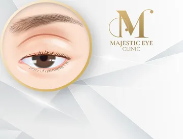 majesticeyeclinic-service8