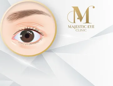 majesticeyeclinic-service9