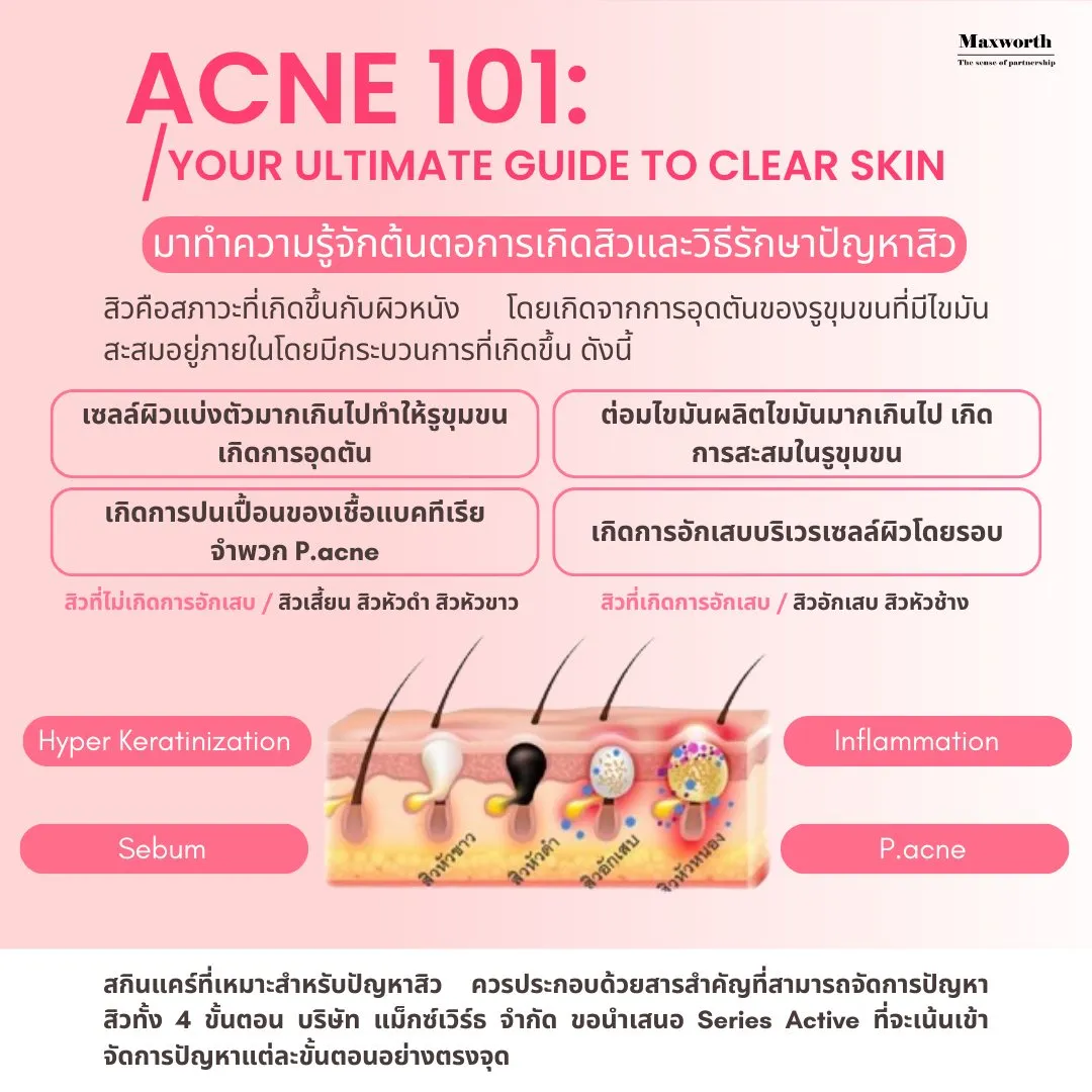 Acne01