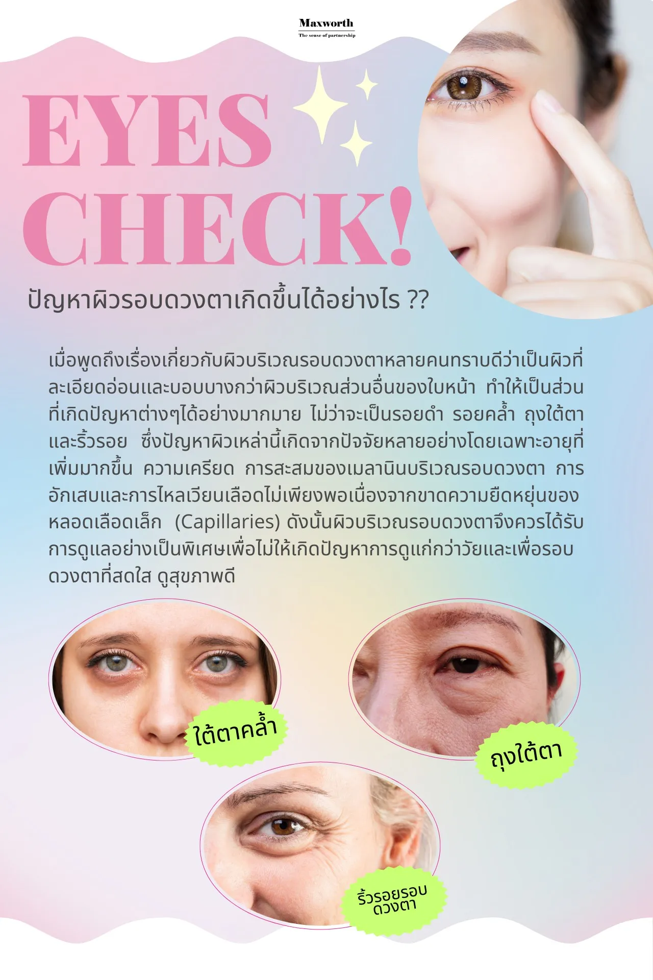 EyeCheck
