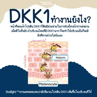 DKK2