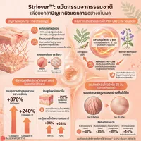 StrioverInfo