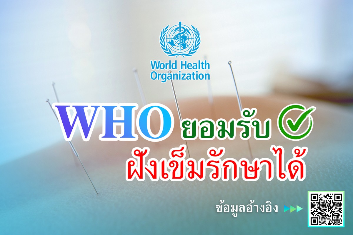 WHO-ยอมรับฝังเข็มรักษาได้