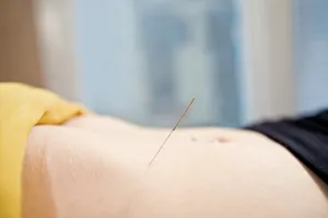 ฝังเข็มท้อง4