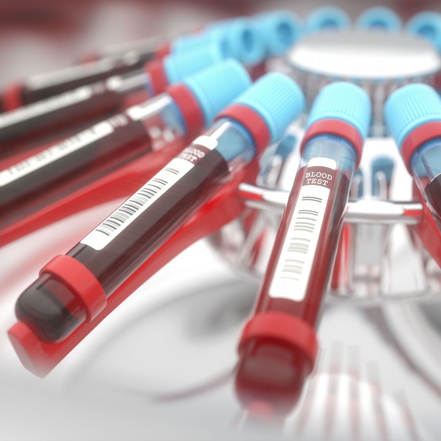 The GLOBAL MATERIAL Solution Supplier