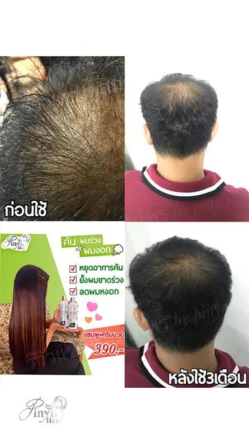 reviewpinya5