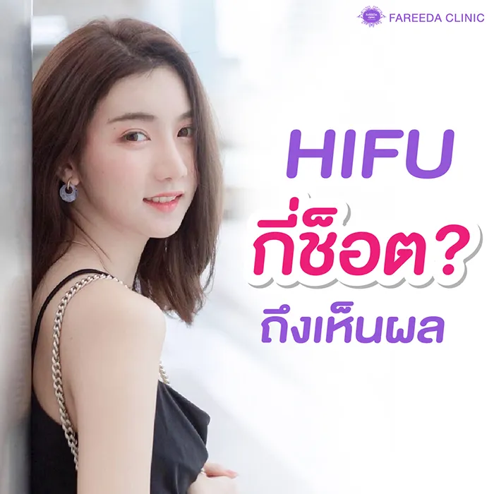 HIFU-กี่ช็อตถึงเห็นผล