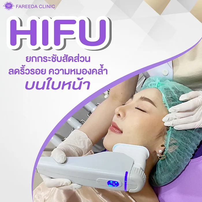 HIFU-ยกกระชับสัดส่วน-ลดริ้วรอย-ความหมองคล้ำ-บนในหน้า