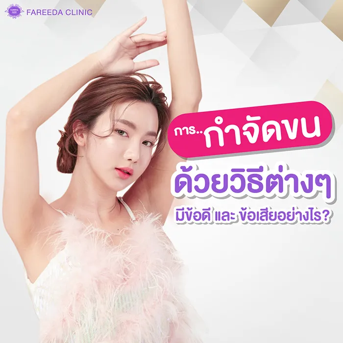 การกำจัดขนด้วยวิธีต่างๆ