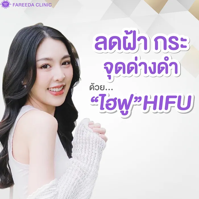 ลบฝ้า-กระจุดด่างดำ-ด้วย-HIFU
