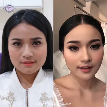 รีวิว-ลดกราม--แฟตแก้ม-2