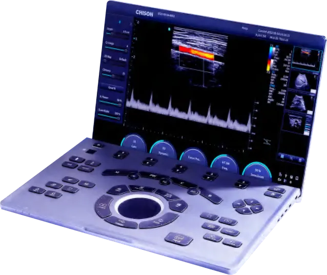 SonoAir70-1