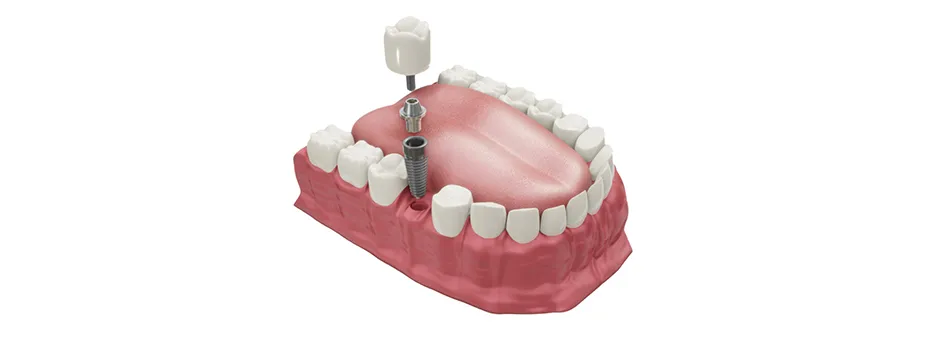 vpdentalbangkok