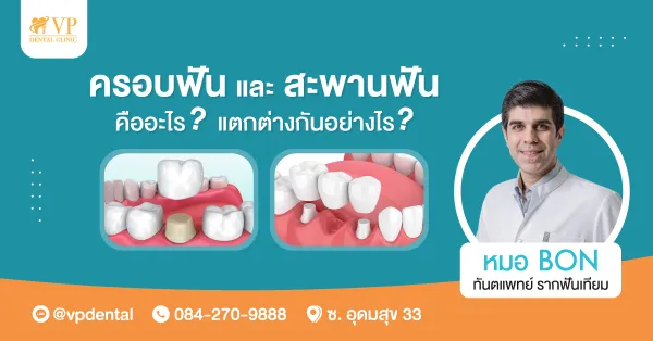 ฟันปลอมชนิดติดแน่น