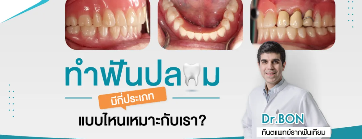 ฟันปลอมมีกี่แบบแบบไหนเหมาะกับเรา