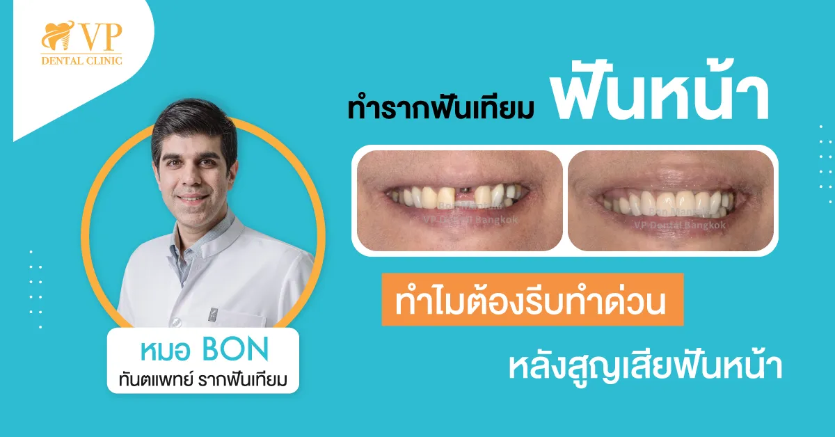 รากฟันเทียมฟันหน้า