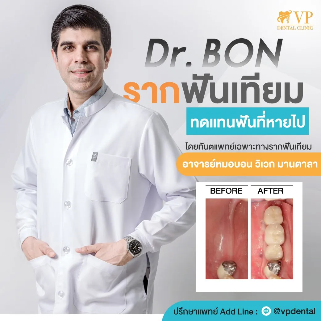 รากฟันเทียมมีข้อห้าม2