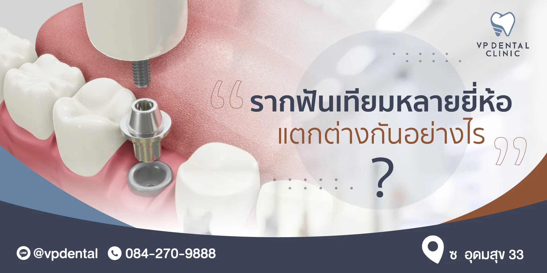 รากฟันเทียมหลาย02