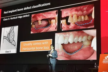 vpdentalbangkok6