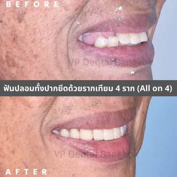 รีวิว(1)