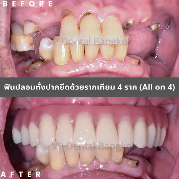 รีวิว(2)