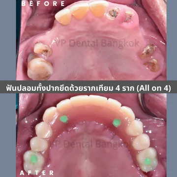 รีวิว(3)