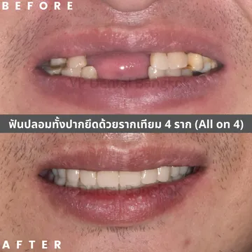 รีวิว(4)