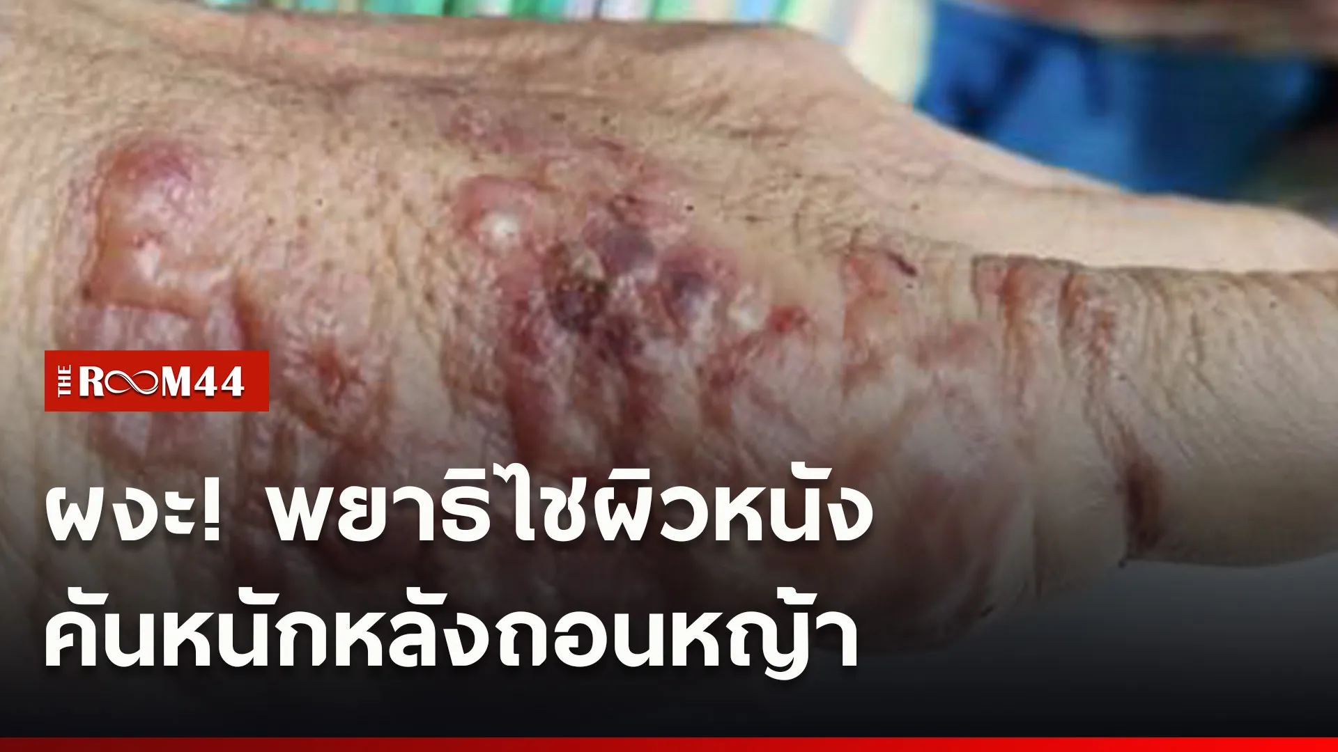 ปกข่าวไลน์ใหม่เว็บ00