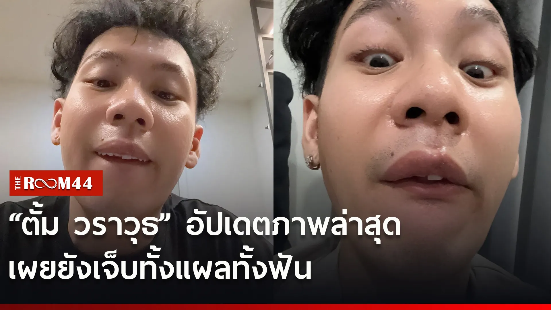 เ่แด