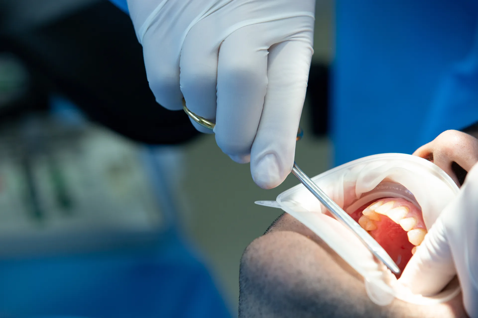 dentist-with-tool-makes-some-manipulations-patient-s-mouth