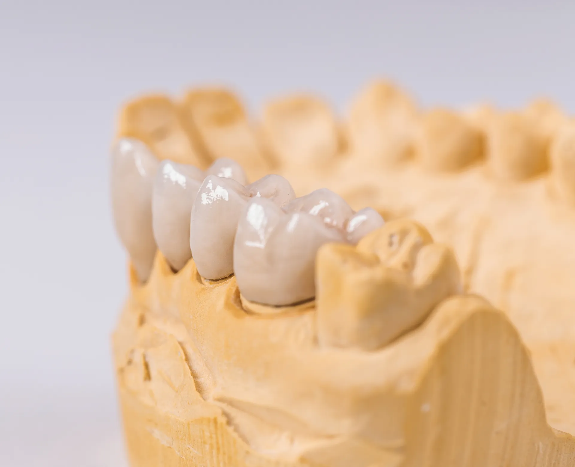denture-made-ceramics