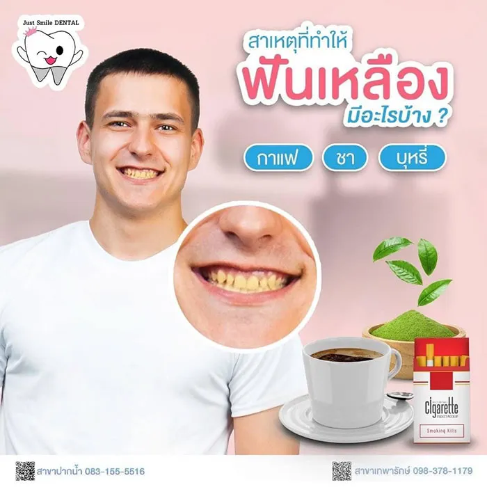 สาเหตุที่ทำให้ฟันเหลืองมีอะไรบ้าง-1