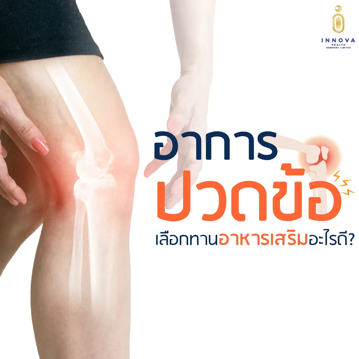 01อาการปวดข้อเลือกทานอาหารเสริมอะไรดี-100