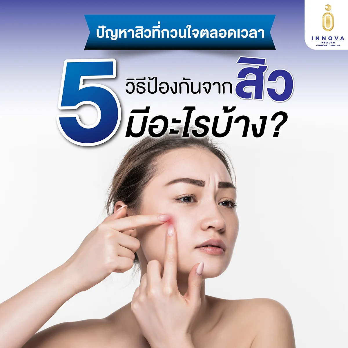 5วิธีป้องกันสิวมีอะไรบ้าง