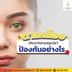 ตาเหลืองเกิดจากสาเหตุอะไรป้องกันอย่างไร
