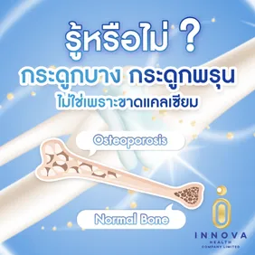 รู้หรือไม่กระดูกบางกระดูกพรุนไม่ใช่เพร0