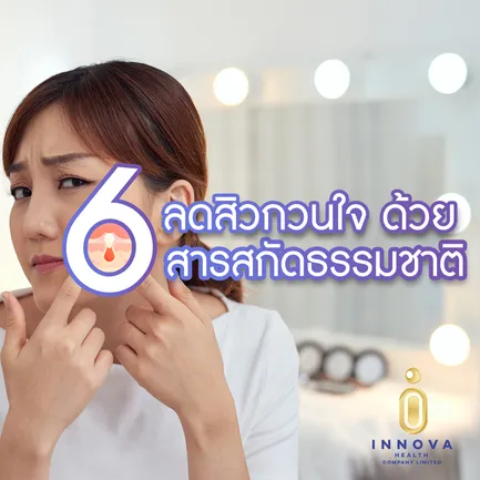 ลดสิวกวนใจ01