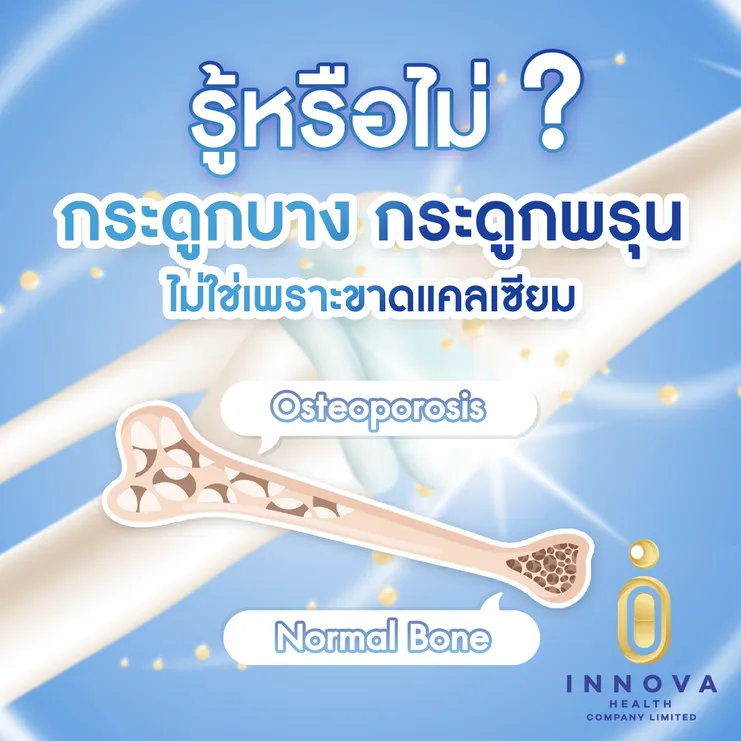 รู้หรือไม่กระดูกบางกระดูกพรุนไม่ใช่เพร0