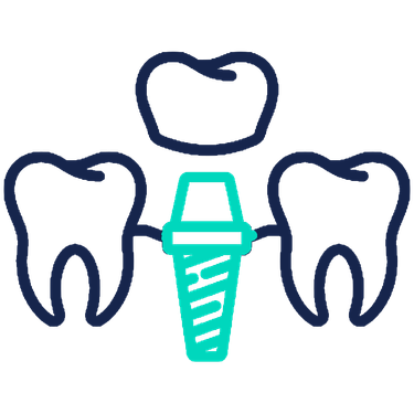 dental-implant