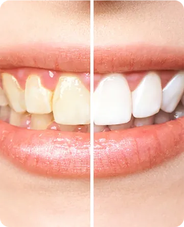 service11-nfinitesmiledentalclinic