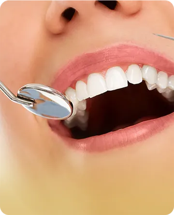 service2-nfinitesmiledentalclinic