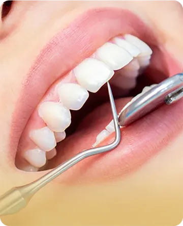 service3-nfinitesmiledentalclinic