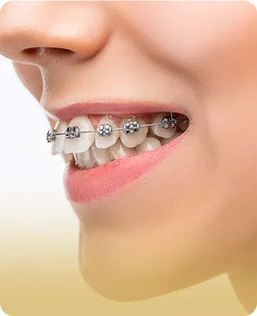 service5-nfinitesmiledentalclinic