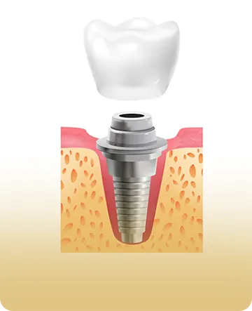 service8-nfinitesmiledentalclinic