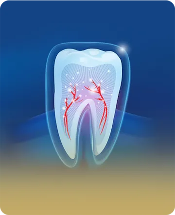 service9-nfinitesmiledentalclinic