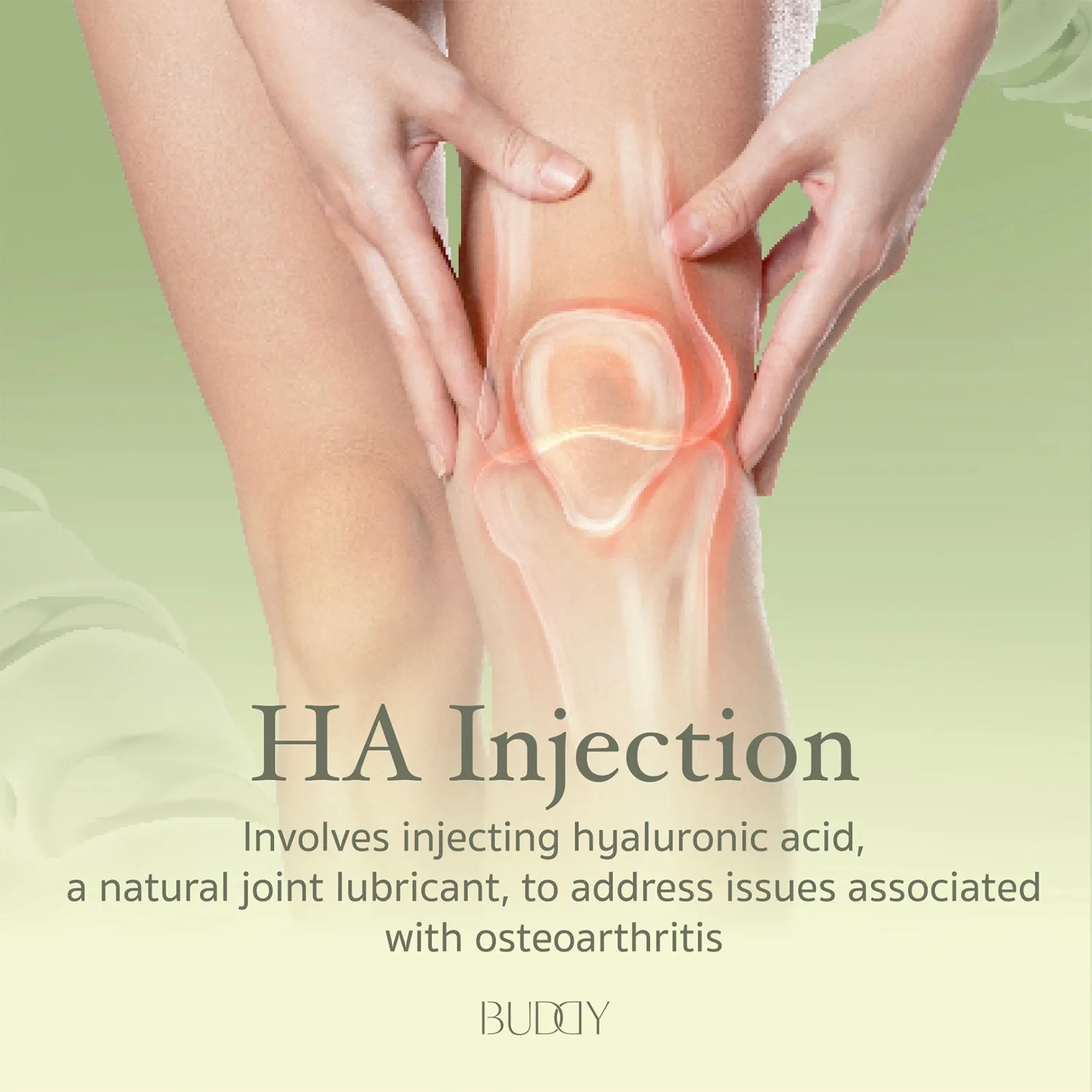 Hyaluronic Acid (HA) Injection